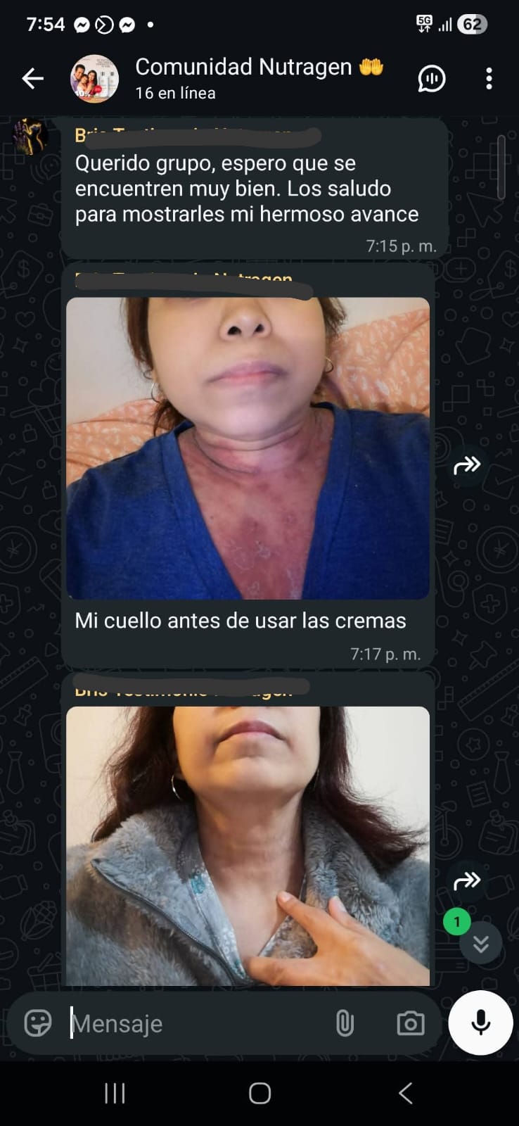 Testimonio cliente Nutragen — mejora visible en psoriasis cuello